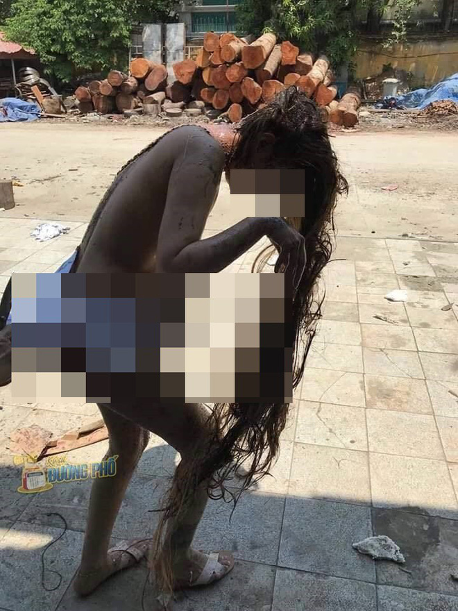 hinh anh co gai bi lot do do mam tom dau luyn khap nguoi va dong chia se ngan gay sot
