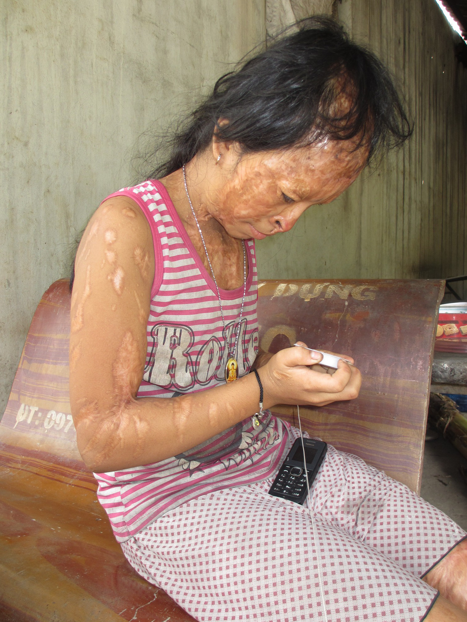 ba noi be gai bi tat axit nam 7 tuoi vi me giat chong nguoi khac toi muon xin doi mat cua tu tu nguyen huu tinh de cuu chau
