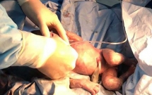 cum a hoanh hanh thuoc tamiflu tang gia theo tung gio