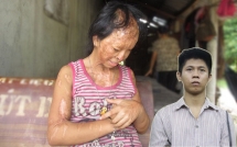 bat giu ke chu muu vu tat axit nu phu bep o hoa binh