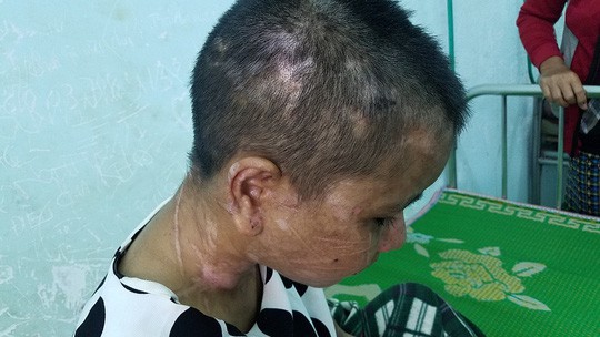 vu co gai bi tra tan da man nhu thoi trung co y nhieu duoc bac si chiem quoc thai tai tro phau thuat mien phi