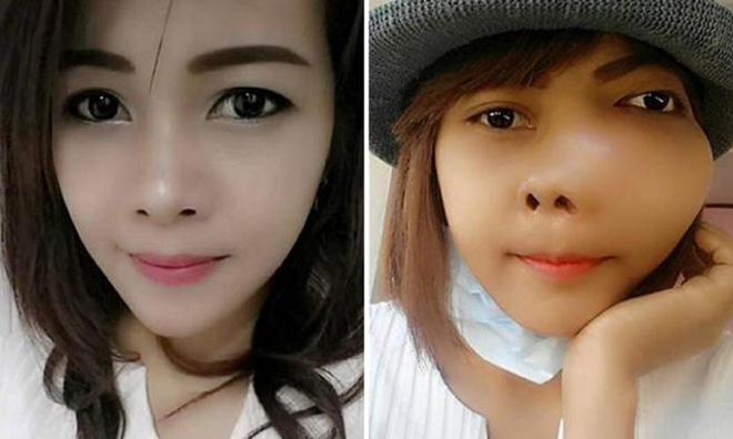 co gai xinh dep qua doi o tuoi 28 2 nam sau khi phat hien minh mac benh ung thu