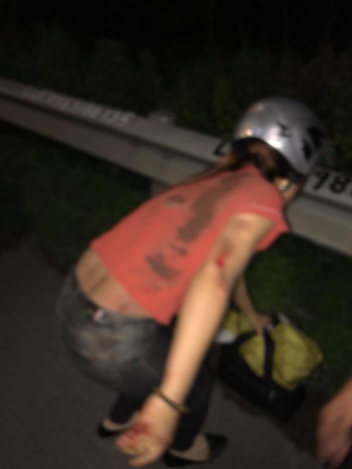 bac ninh 2 vo chong bi cuop giat tui xach giua duong chong nga bat tinh ngay trong dem