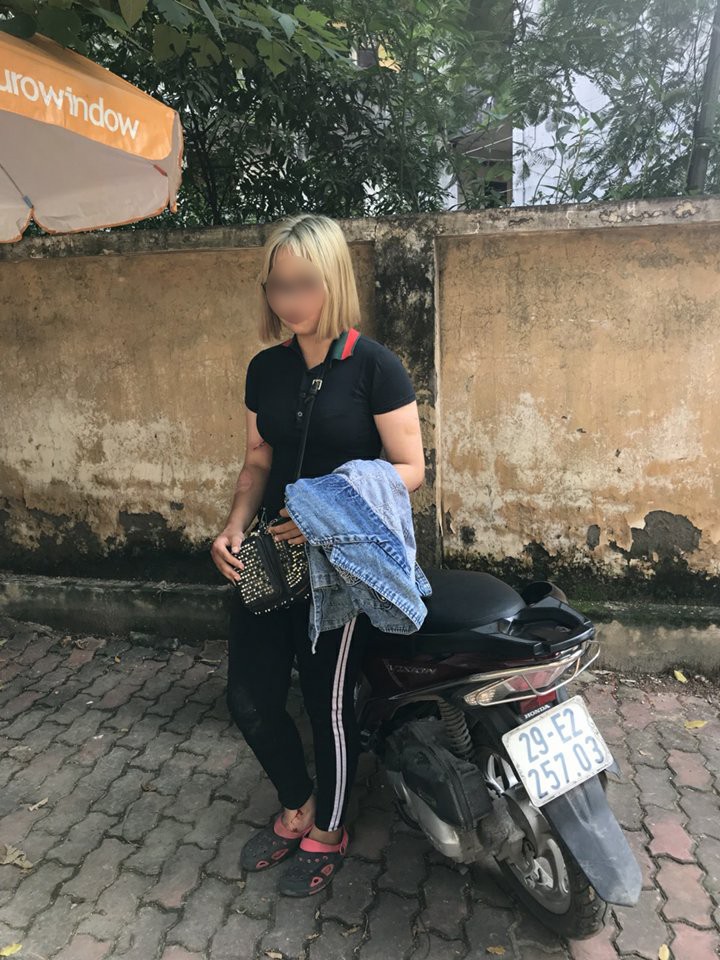 chien si cscd ha noi bi thieu nu toc vang tong xe vao da on dinh suc khoe