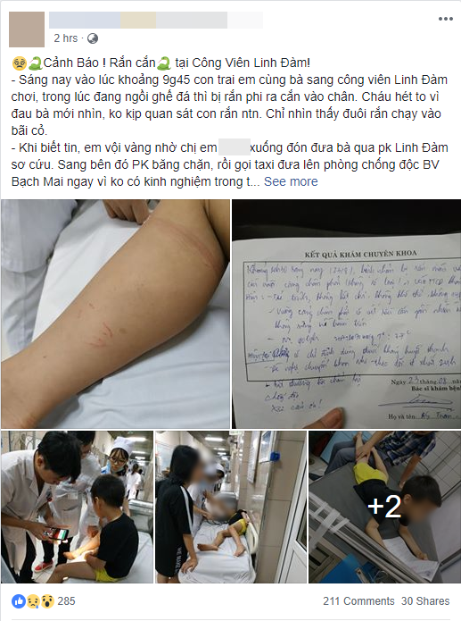 ha noi be trai bi ran can khi dang choi cung ba noi trong cong vien o linh dam phai nhap vien theo doi