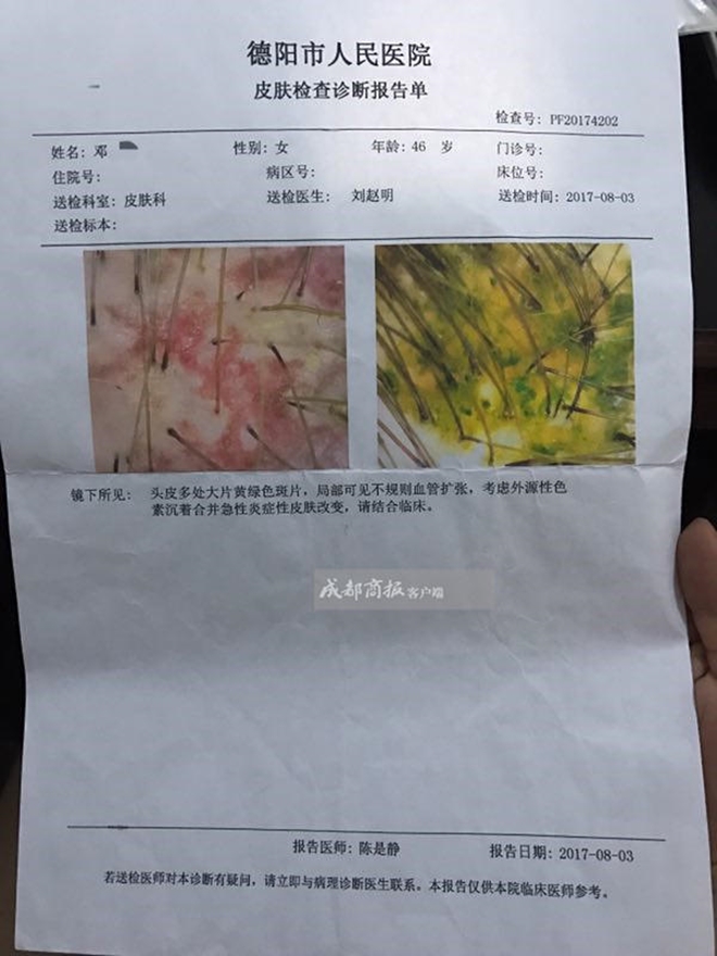 nhuom toc 4 lan trong 7 tieng de co mau xanh la nguoi phu nu bi soc phan ve va cai ket khong mong muon