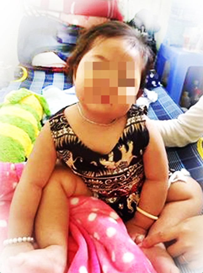 be gai 32 thang tuoi nhiem trung nang sau tiem ngua va con so bao dong 55 nhan vien y te tai viet nam chua biet tiem an toan