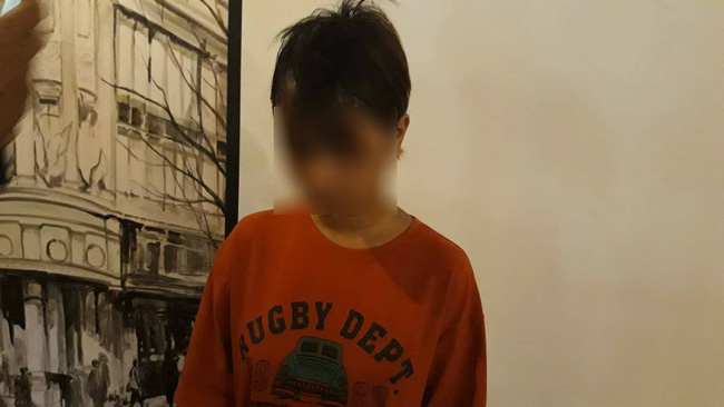 tphcm thieu nu 14 tuoi bi nhom thanh nien la mat chem len dau khong ro ly do phai khau gan 30 mui