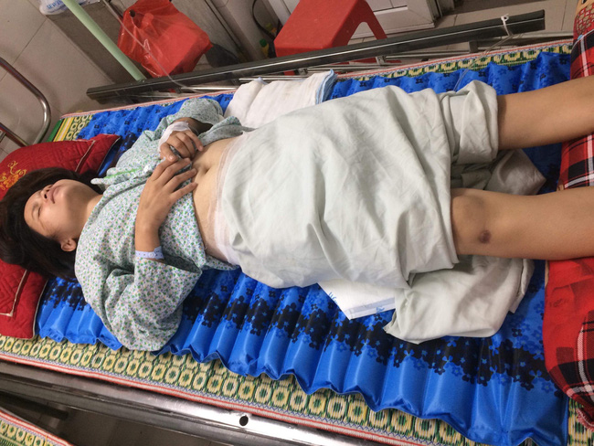 bi bong nang da thit thoi rua nguoi phu nu bi te liet chan tay van phai can rang chiu dung vi khong du tien nhap vien