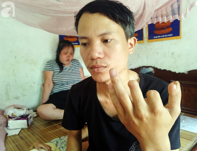 ba me tre bi ung thu giai doan cuoi dau don nhin 2 con tho lam benh ma khong co tien chay chua