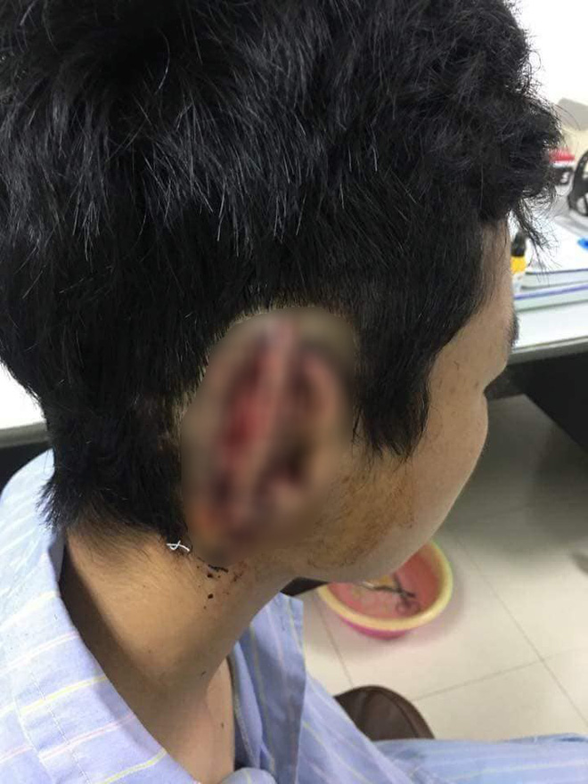 nam sinh nghi ngao da can dut roi nuot tai phai cua ban vao bung