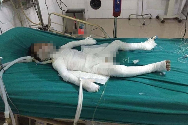 vu con re dot nha bo vo o ha noi be trai 6 tuoi bi bo duong tam xang dot bong 98 da qua doi