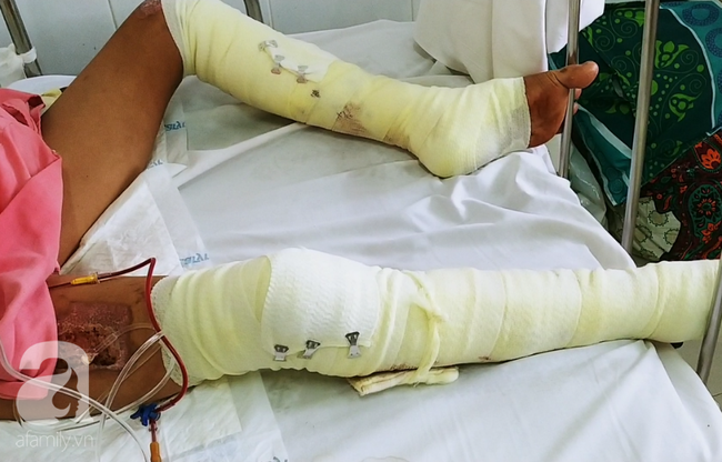 nguoi phu nu mat em trai nuoi chong nguy kich vi chay nha neu co phep mau em chi mong duoc doi mang cho chong