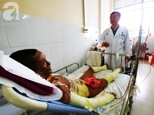 nguoi phu nu mat em trai nuoi chong nguy kich vi chay nha neu co phep mau em chi mong duoc doi mang cho chong