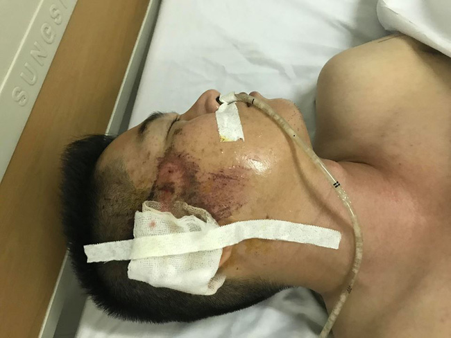 vu tai xe taxi nghi bi ban dan cao su chen qua nguoi chua co thong tin ve doi tuong