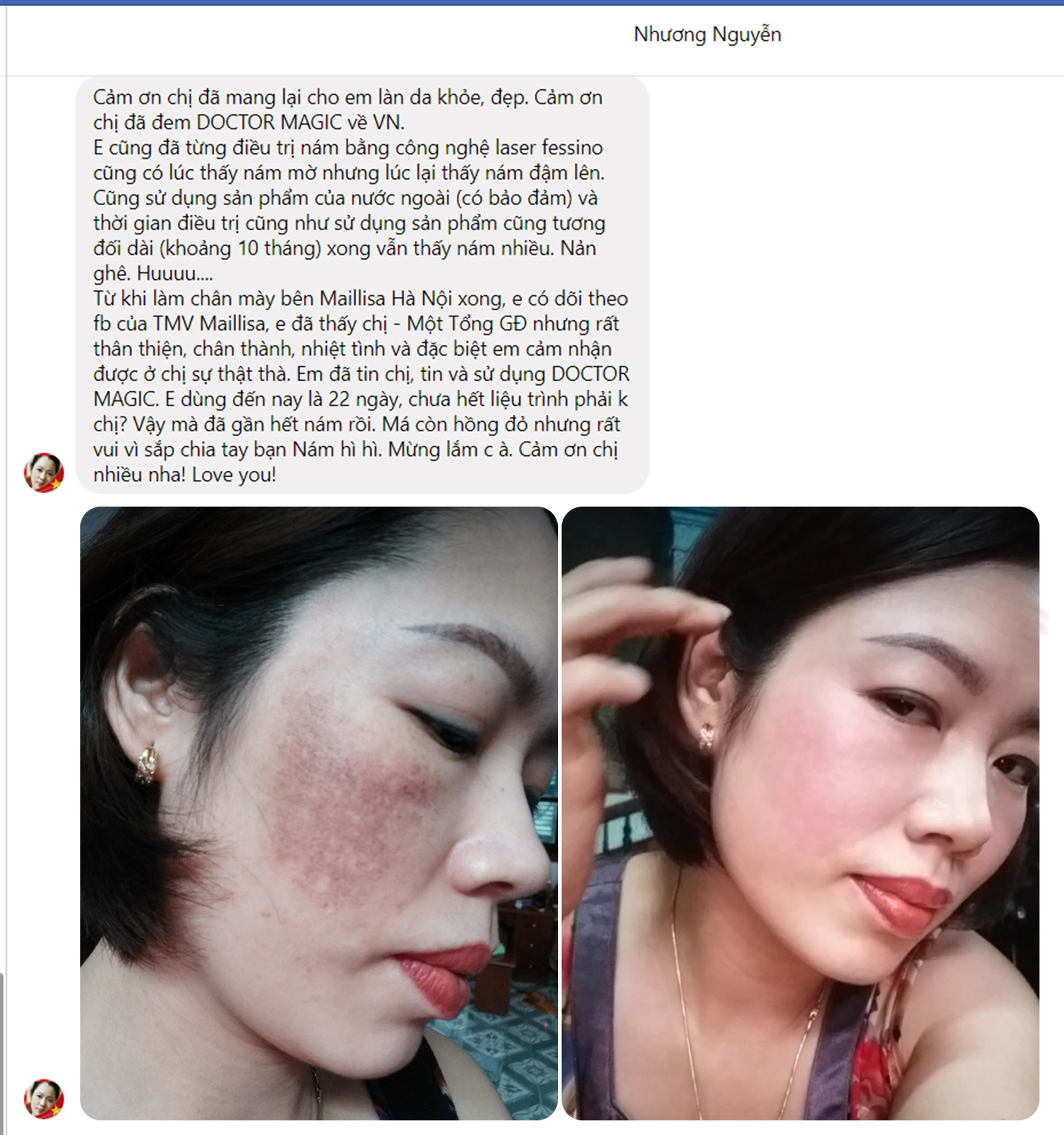 dong san pham doctor magic dem lai lan da sang dep cho chi em phu nu