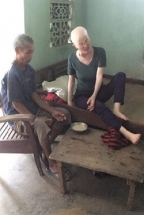 Nghệ An: Xót thương gia cảnh chồng tàn tật chăm vợ ung thư, con dính ruột