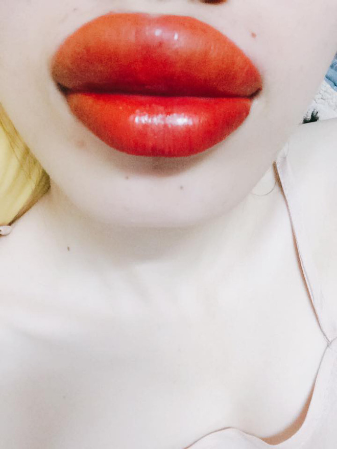 tin loi tham my vien quang cao phun moi khong sung co gai tre lam xong moi teu nhu qua tao