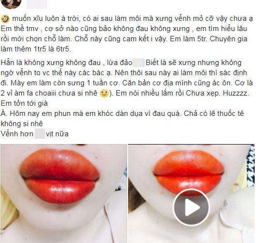 tin loi tham my vien quang cao phun moi khong sung co gai tre lam xong moi teu nhu qua tao