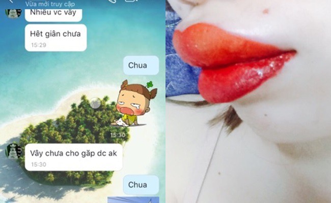 tin loi tham my vien quang cao phun moi khong sung co gai tre lam xong moi teu nhu qua tao