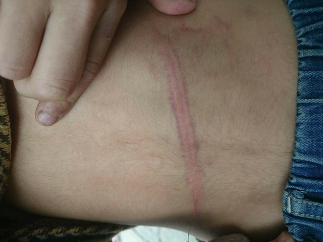 vu bo ruot dung day dien danh dap con trai 9 tuoi da man do toi hoi nong tinh nen da danh con
