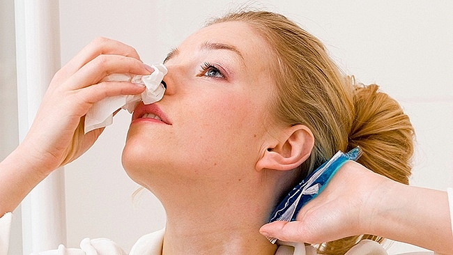 Điều trị chảy máu cam bằng bài thuốc đơn giản dieu tri chay mau cam bang bai thuoc don gian