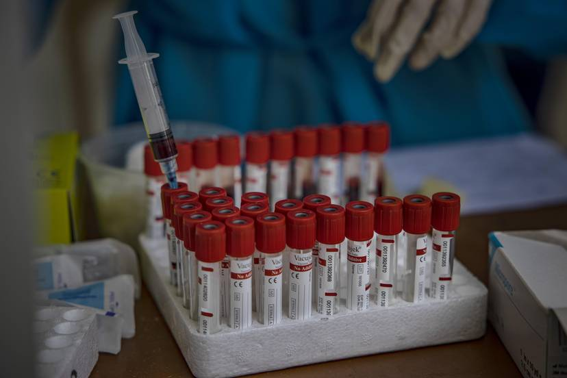 Blood samples to be tested for COVID-19 are seen outside a hospital on August 3, 2020 in Manila, Philippines 0747 vac1