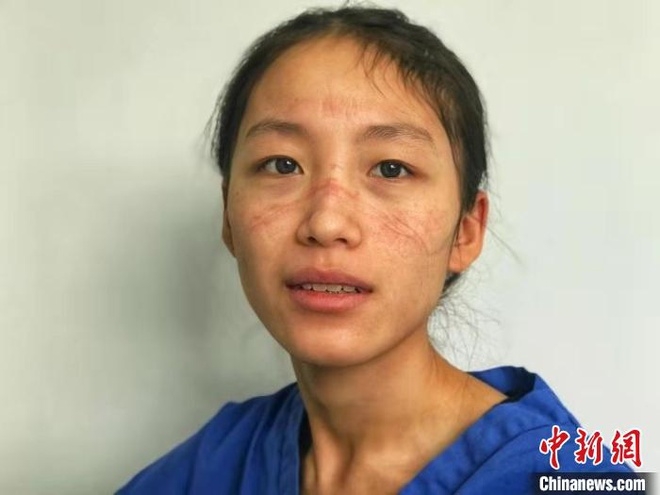 Bức ảnh y tá chống dịch corona hôn bạn trai qua tấm kính cách ly khiến nghìn người xúc động buc anh y ta chong dich corona hon ban trai qua tam kinh cach ly khien nghin nguoi xuc dong