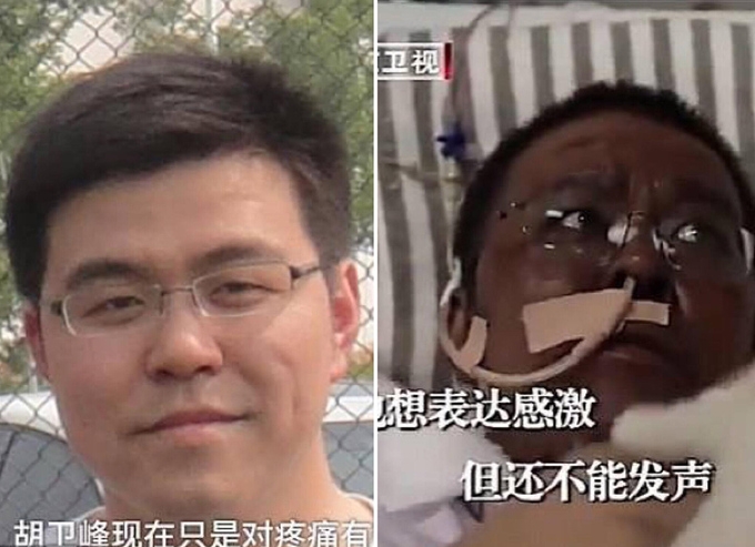 Hai bác sĩ Vũ Hán chuyển màu da nâu sau thời gian chống chọi Covid-19 hai bac si vu han chuyen mau da nau sau thoi gian chong choi covid 19