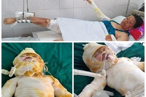 Tin tức trong ngày 4/6 mới nhất: Chập điện, cháy điều hòa khiến gia đình 4 người thương vong tin tuc trong ngay 46 moi nhat chap dien chay dieu hoa khien 4 nguoi thuong vong