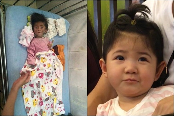 Cô gái xinh đẹp gác lại mọi giấc mơ tuổi 20 để làm mẹ một em bé tật nguyền co gai tre gac lai moi giac mo de lam me mot em be tat nguyen