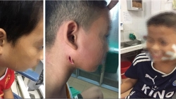 vu 3 anh em ruot tu vong vi whitmore phat hien mau dat nhiem khuan o do sau 90cm