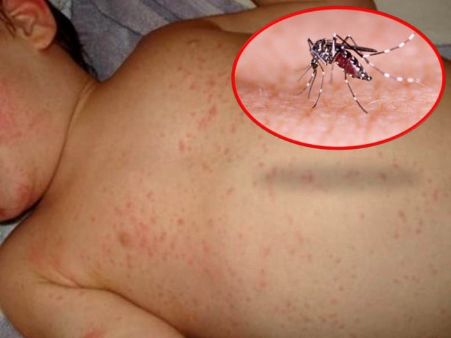 Các nước châu Á đối phó với dịch sốt xuất huyết bùng phát bất thường cac nuoc chau a doi pho voi dich sot xuat huyet bung phat bat thuong