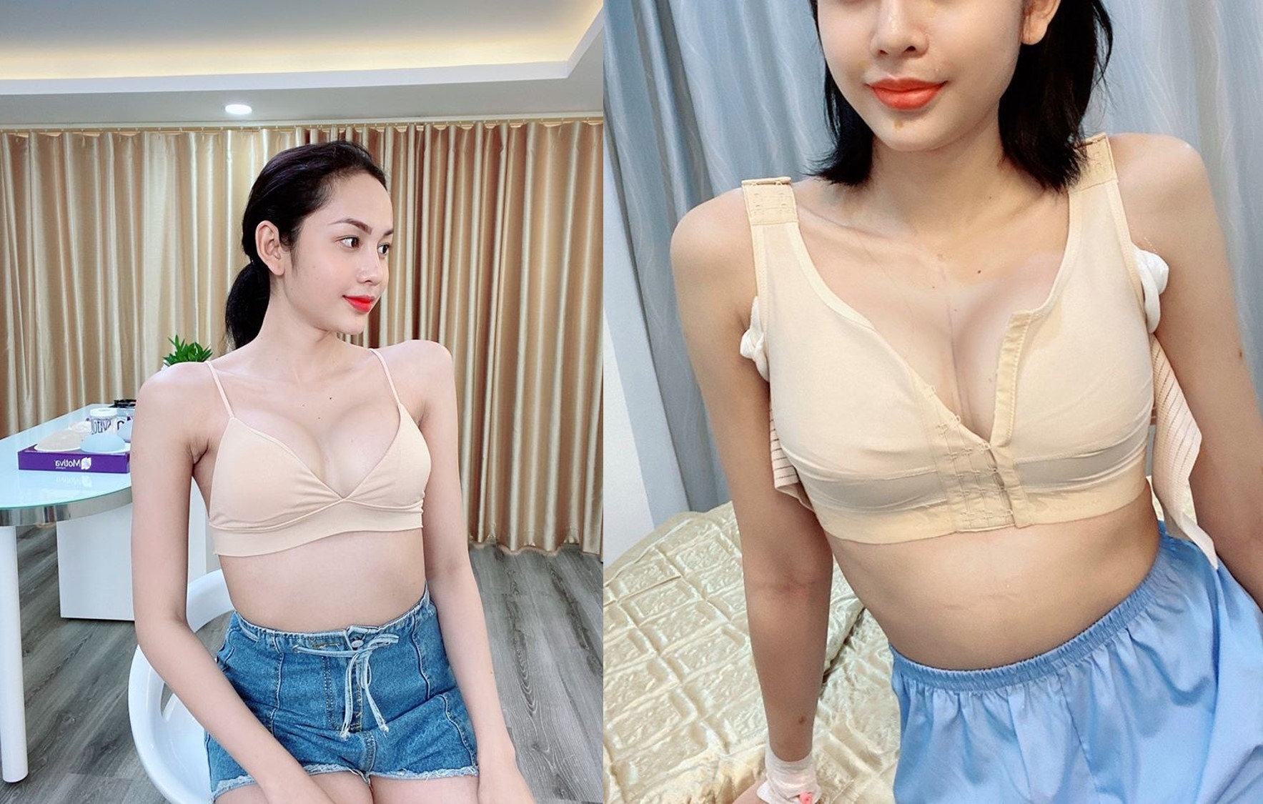 Nhan sắc gây bất ngờ sau khi chuyển giới của nam thí sinh từng thi 'Thách thức danh hài' nhan sac gay bat ngo sau khi chuyen gioi cua nam thi sinh tung thi thach thuc danh hai