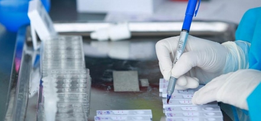 Labelling Covid-19 test samples. Photo: VOV Labelling Covid-19 test samples. Photo: VOV