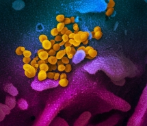 coronavirus updates march 20 the disease outbreak still in control with two patients got the first negative test