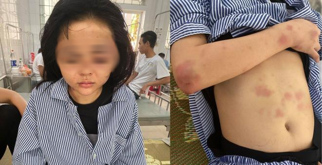 3611 cong an trieu tap ga thanh nien xam tro hanh hung co gai suot 2 gio vi khong duoc dap ung tinh cam e9d 5010907
