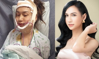 Hành trình quot lột xác quot ngoạn mục của nữ ca sỹ Lynk Lee hanh trinh lot xac ngoan muc cua nu ca sy lynk lee