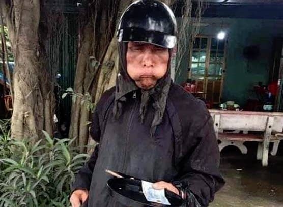 tin tuc 24h moi nhat nong nhat hom nay 512