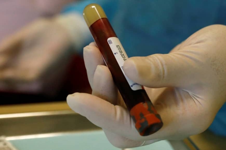 Group A blood? You are at higher risk for Covid-19 4514 np file 18602 870x580