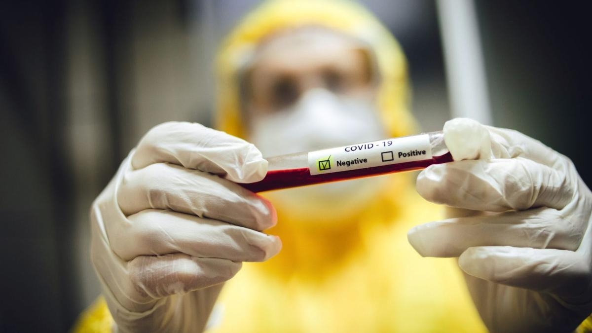 Group A blood? You are at higher risk for Covid-19 5050 5ee0c70a082adimage