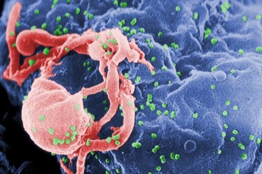 Đằng sau ba trường hợp bệnh nhân được chữa khỏi HIV dang sau ba truong hop benh nhan duoc chua khoi hiv