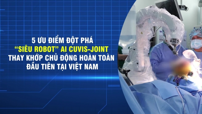 5 công nghệ đỉnh cao của Robot AI CUVIS-Joint